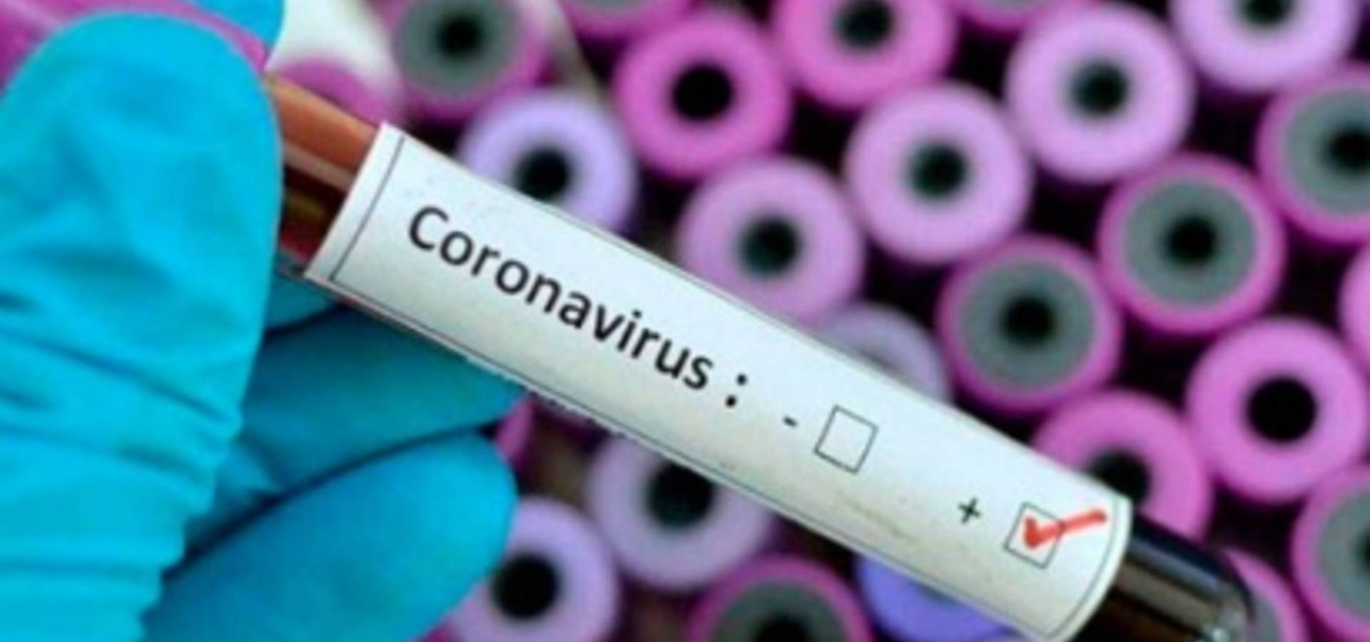 На Вінниччині уже більше 20 хворих на коронавірус