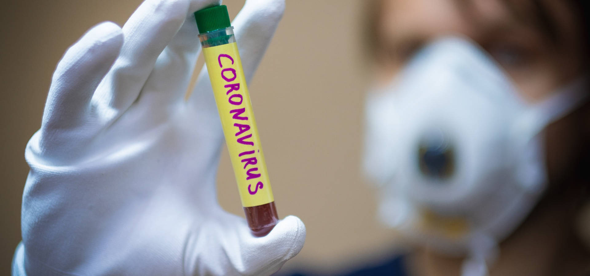 У Хмільнику на Вінниччині  зафіксовано перший випадок захворювання на коронавірус