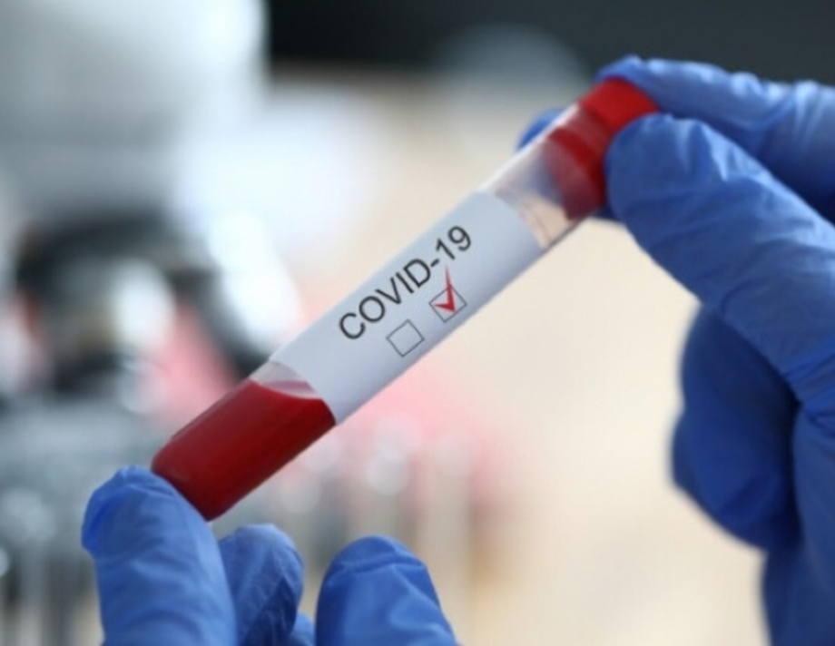 На Вінниччині за добу коронавірус виявлено у 562 осіб