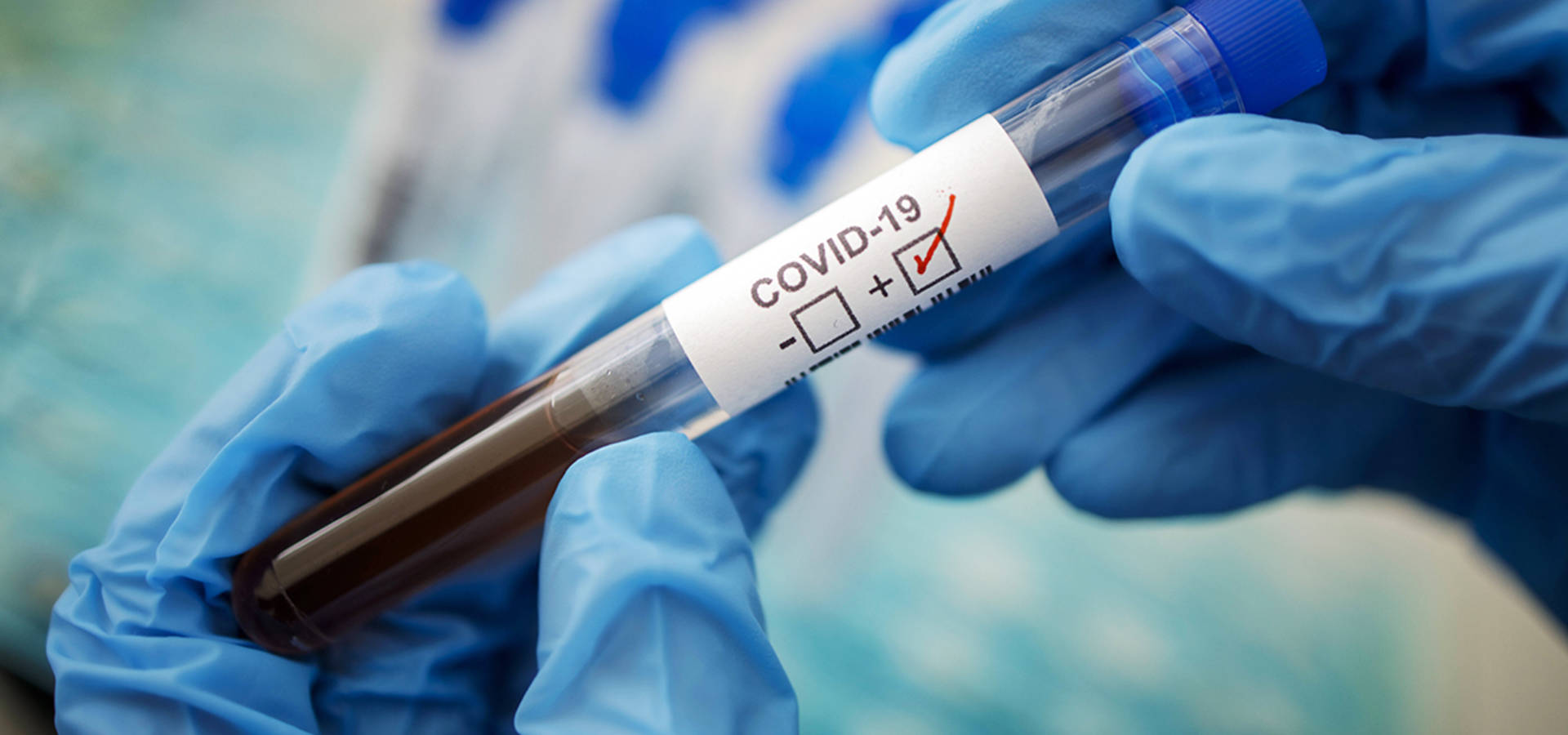 В Хмільницькому районі за три доби зафіксовано 13 нових випадків  захворювання на COVID-19