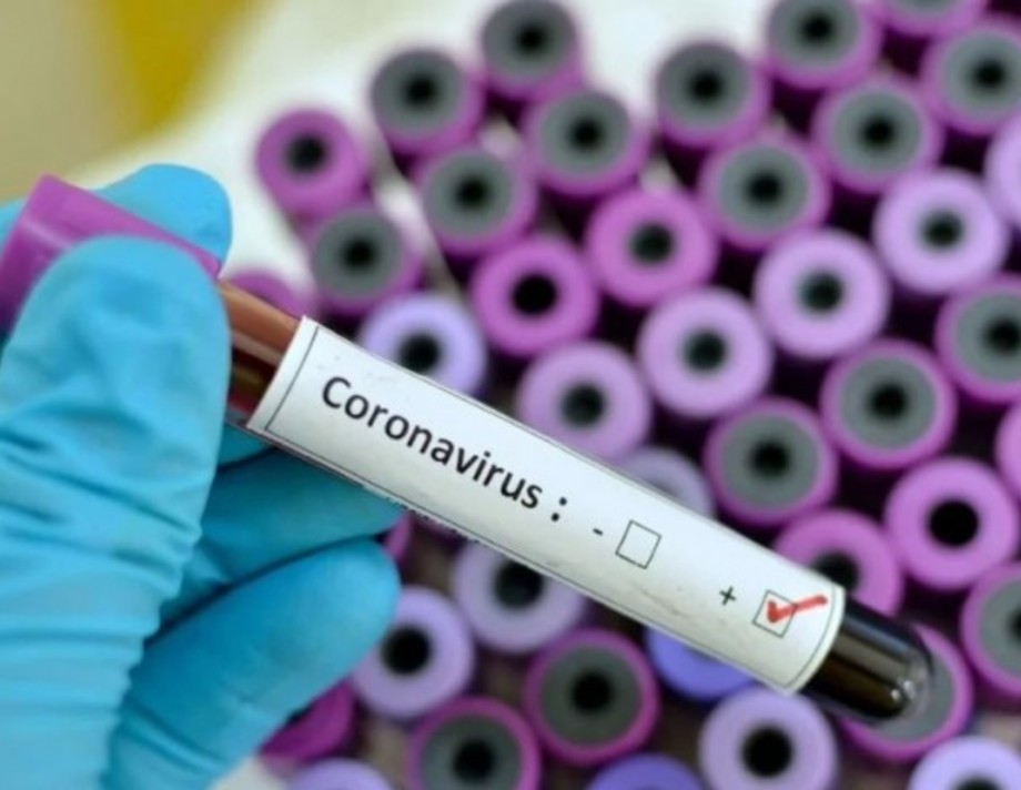 В Хмільницькому районі за 3 доби зафіксовано 17 нових випадків захворювання на COVID-19