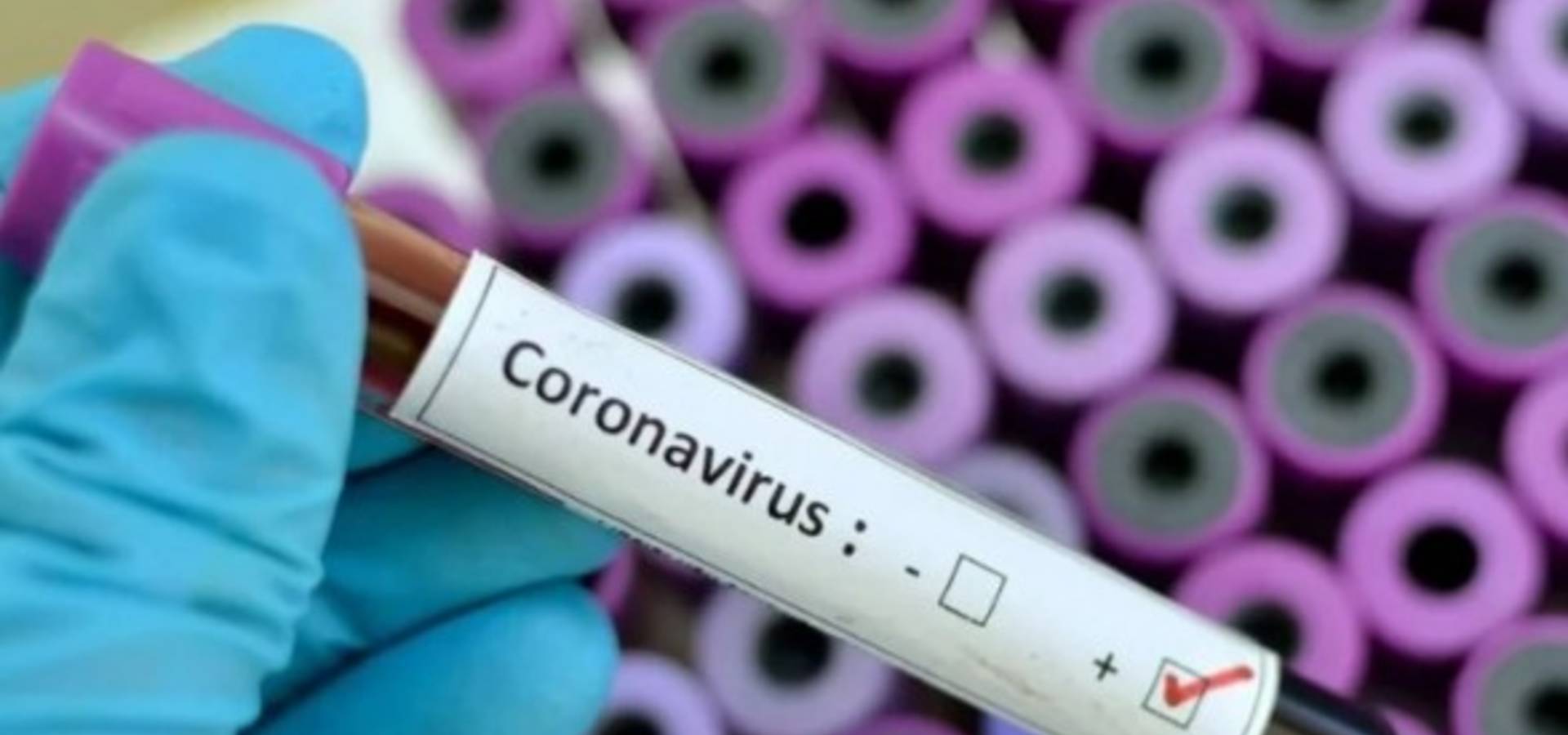 В Хмільницькому районі за 3 доби зафіксовано 17 нових випадків захворювання на COVID-19