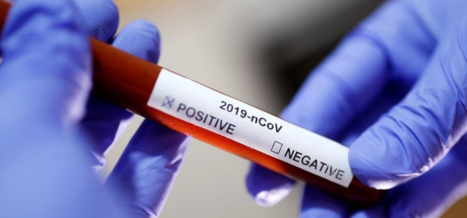 13 нових випадків захворювання на коронавірус виявлено в Хмільницькому районі на Вінниччині
