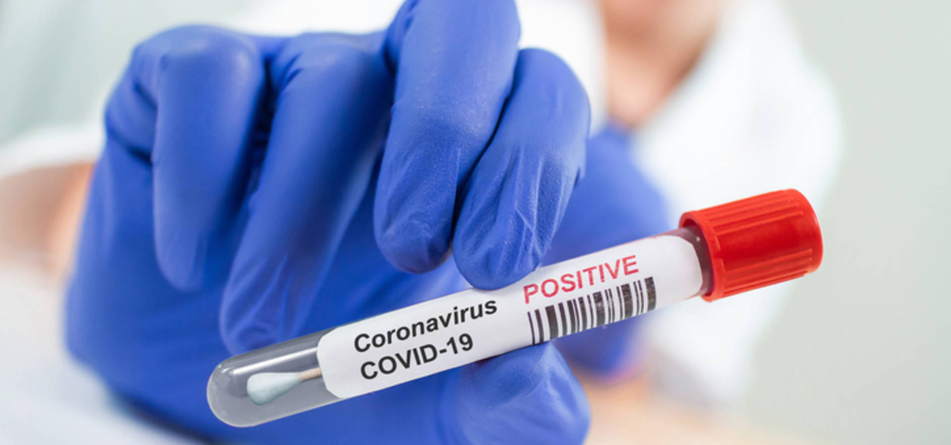 33 нових хворих на COVID-19 виявили в Хмільницькому районі за добу