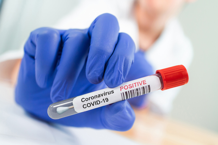 Istock covid swab specimin