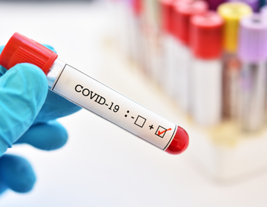 77 нових хворих на COVID-19 виявили в Хмільницькому районі за добу