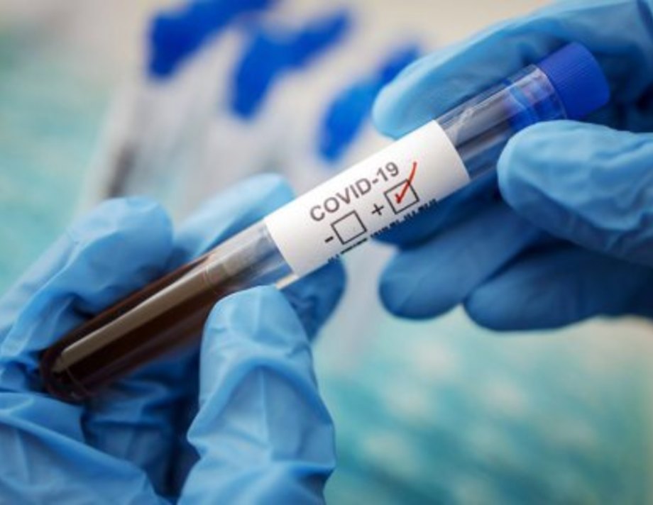 152 нових хворих на COVID-19 виявили в Хмільницькому районі за добу