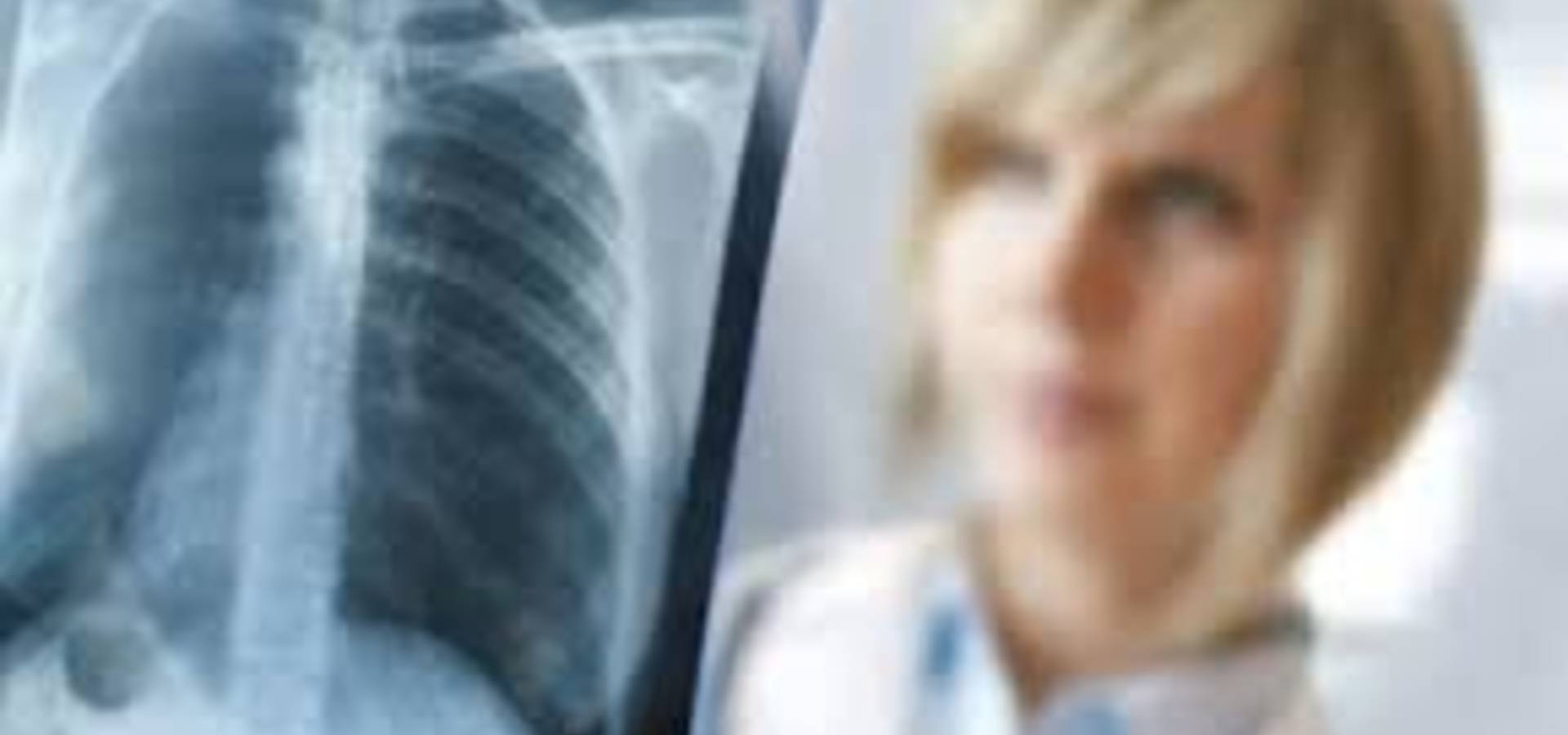 У Хмільницькому районі зросла кількість хворих туберкульозом