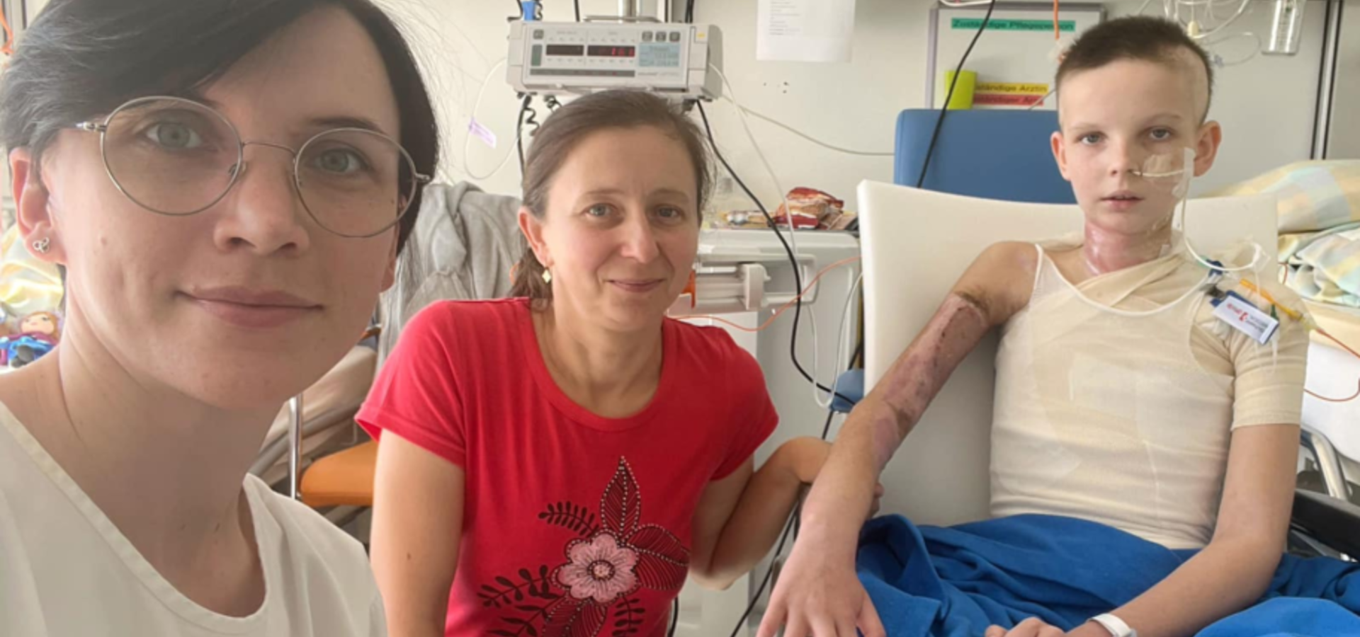 Дівчинку з Хмільника рятували опікові хірурги одразу двох країн — України та Швейцарії
