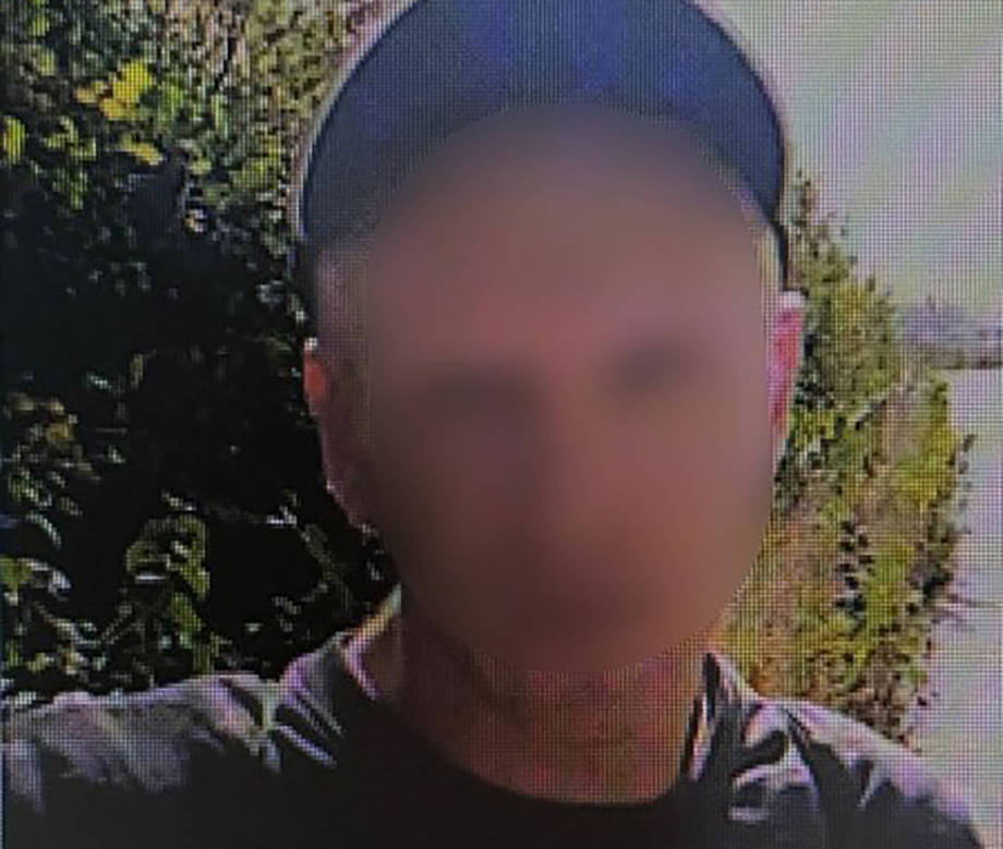 У Хмільнику чоловік скалічив свою дружину. Медики зафіксували у неї численні переломи та серйозні пошкодження